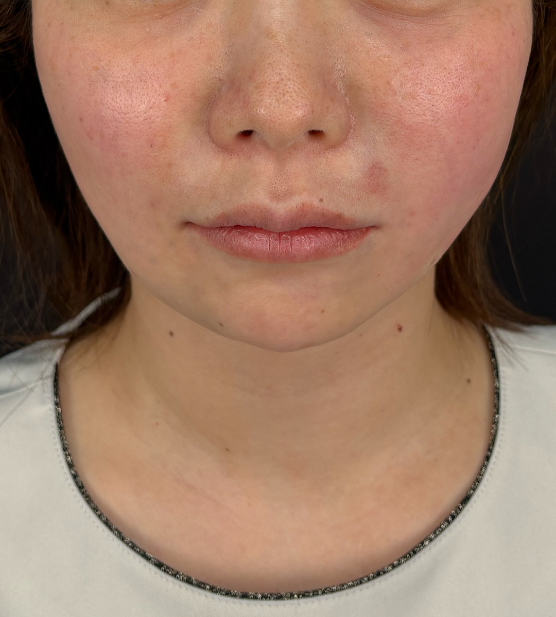 After