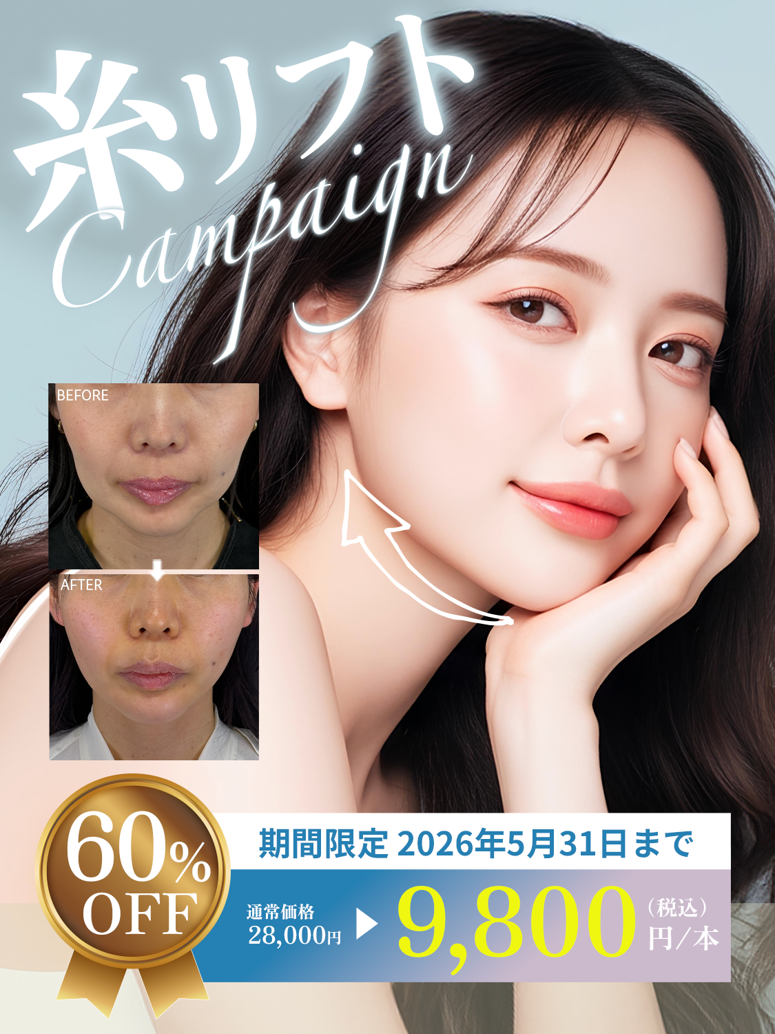 糸リフトCampaign