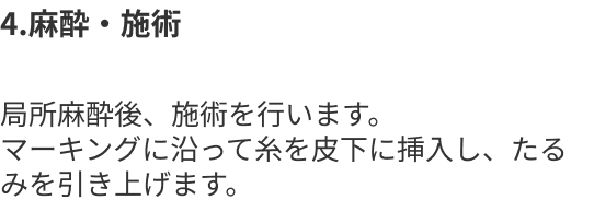 4.麻酔・施術
